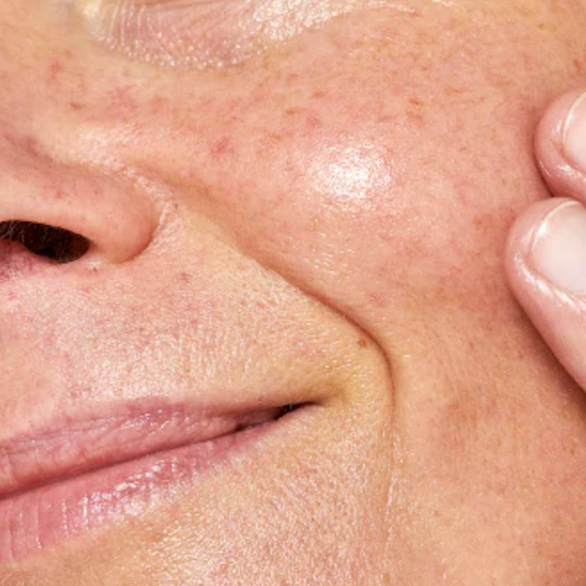 Reveal Your Radiance — Solutions for Dull Skin & Uneven Texture