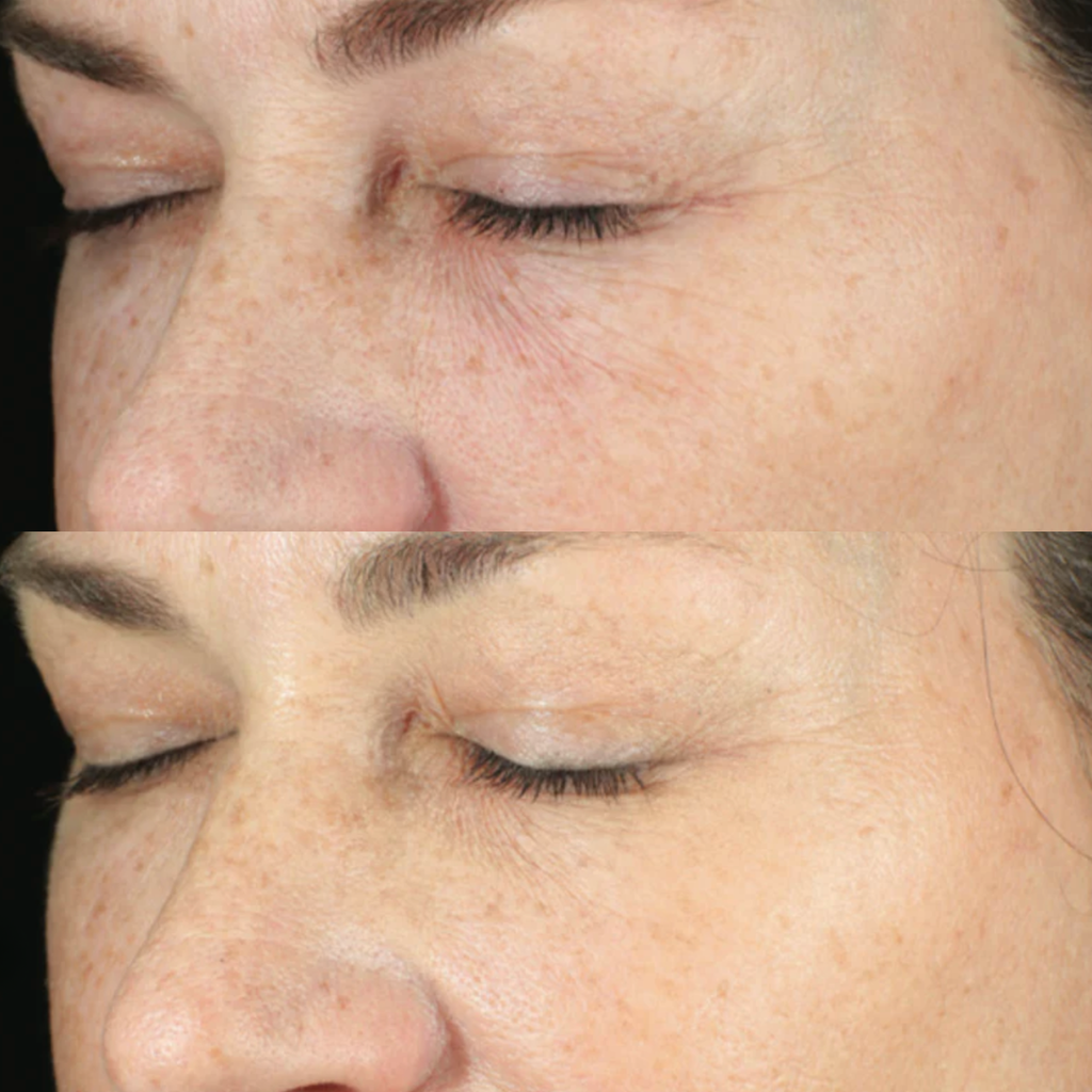 RetaXome Daily Retinal Hydrator