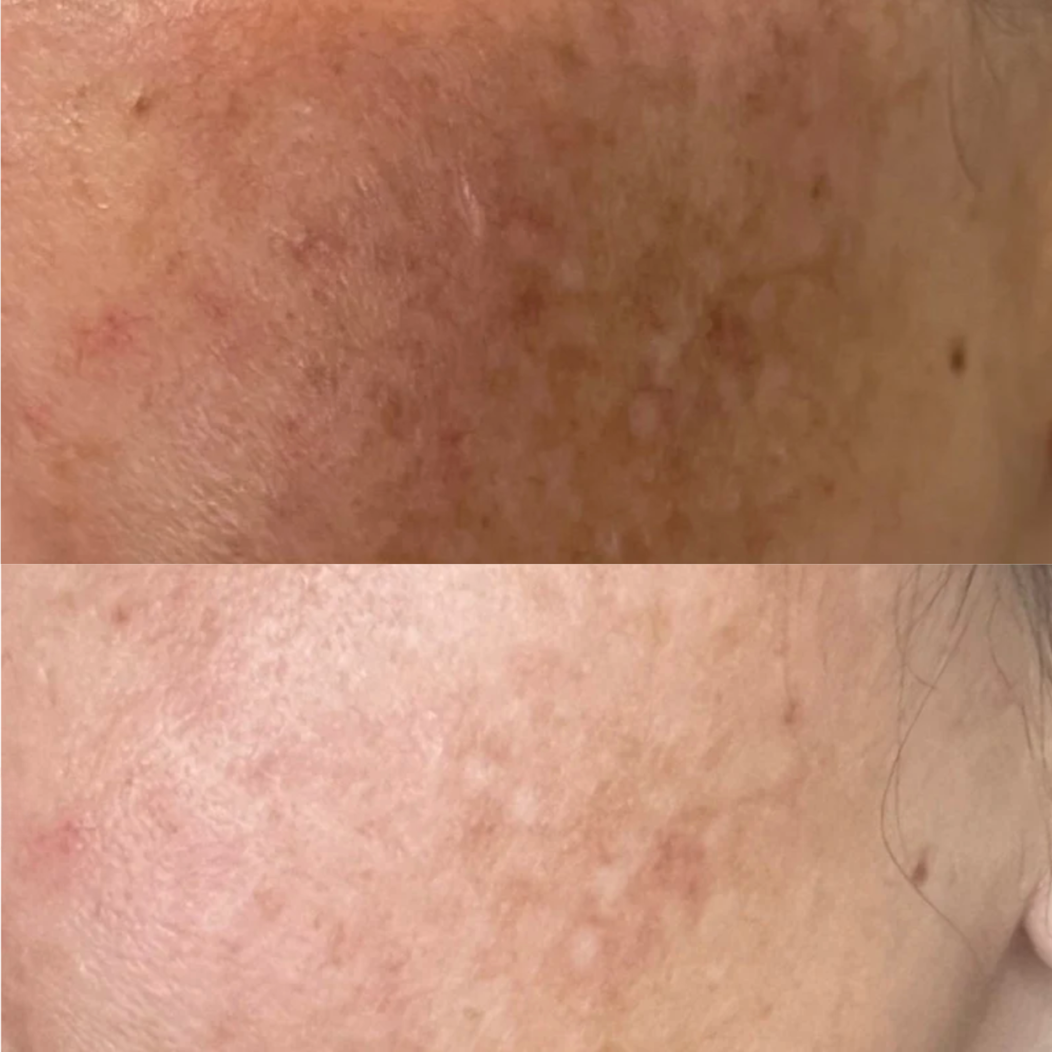 VIVID Brightening Serum